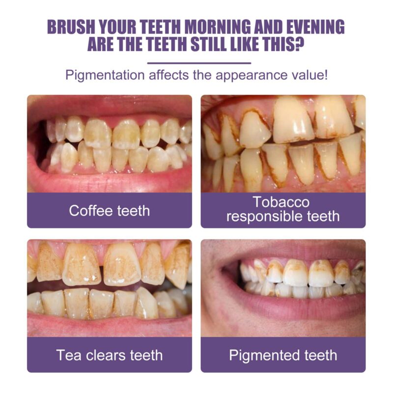 Teeth Cleaning Powder - Tartar/Stain Removal, White Teeth & Oral Care, Dental Powder - Image 3