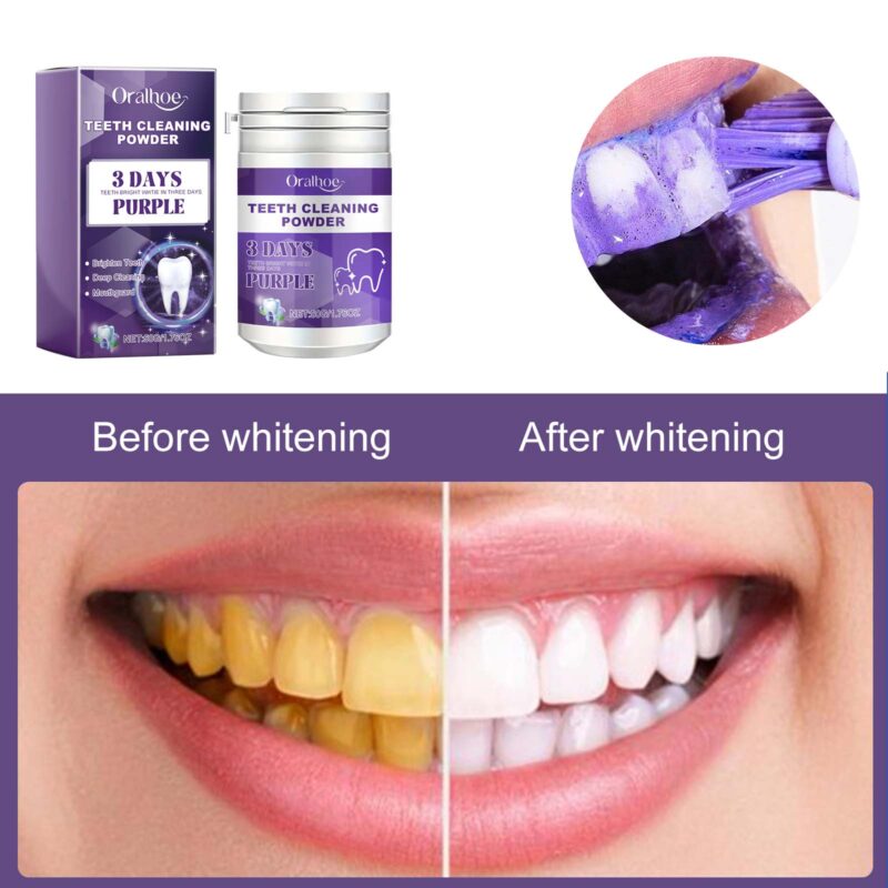 Teeth Cleaning Powder - Tartar/Stain Removal, White Teeth & Oral Care, Dental Powder - Image 4