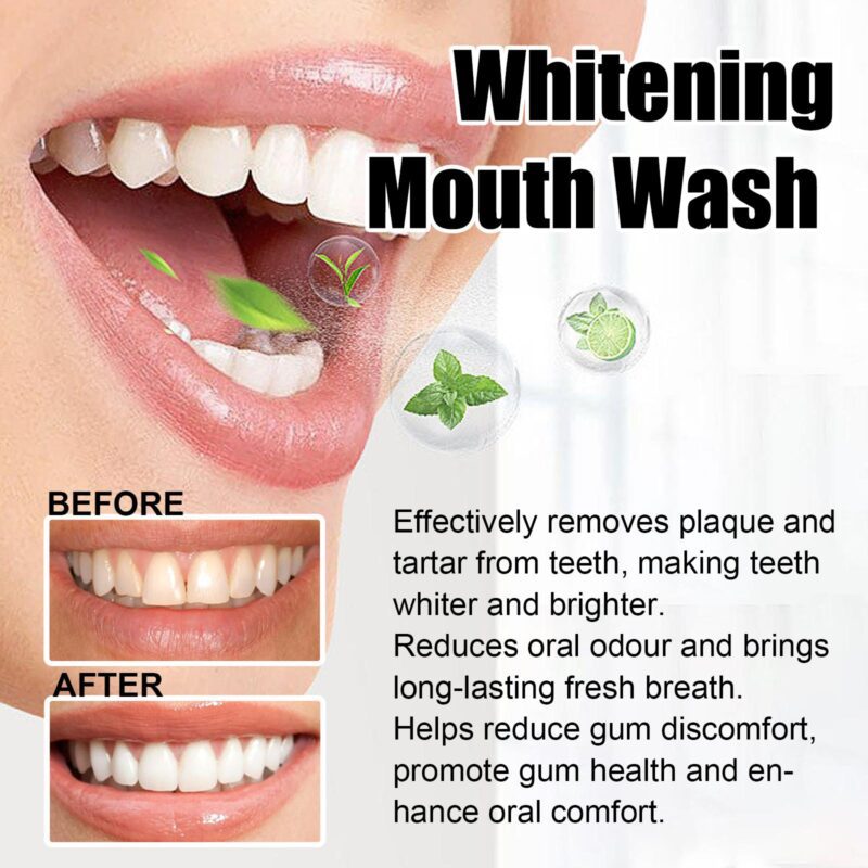 Whitening Mouthwash - Teeth Shine, Gum Care & Fresh Breath, Daily Oral Hygiene - Image 4