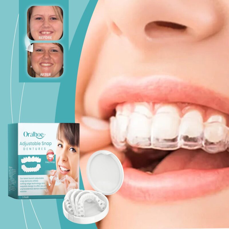 Adjustable Buckle Dentures - Comfortable Fit, Mouth Chewing Force & Orthodontic Care, Dentures - Image 2