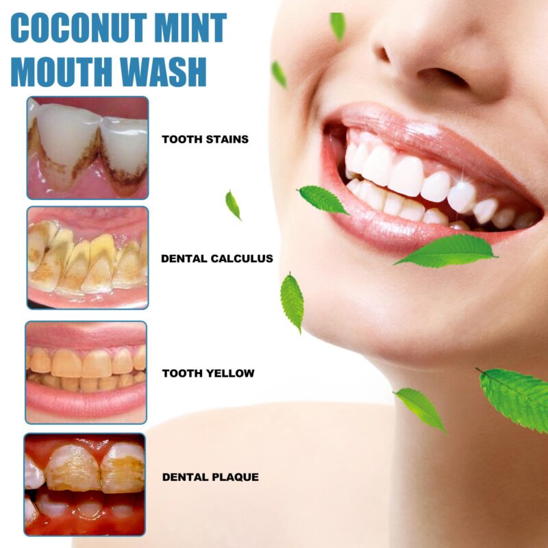 Coconut Mint Mouthwash - Yellow Stain/Tongue Clean, Teeth Whitening & Fresh Breath, Oral Care - Image 3