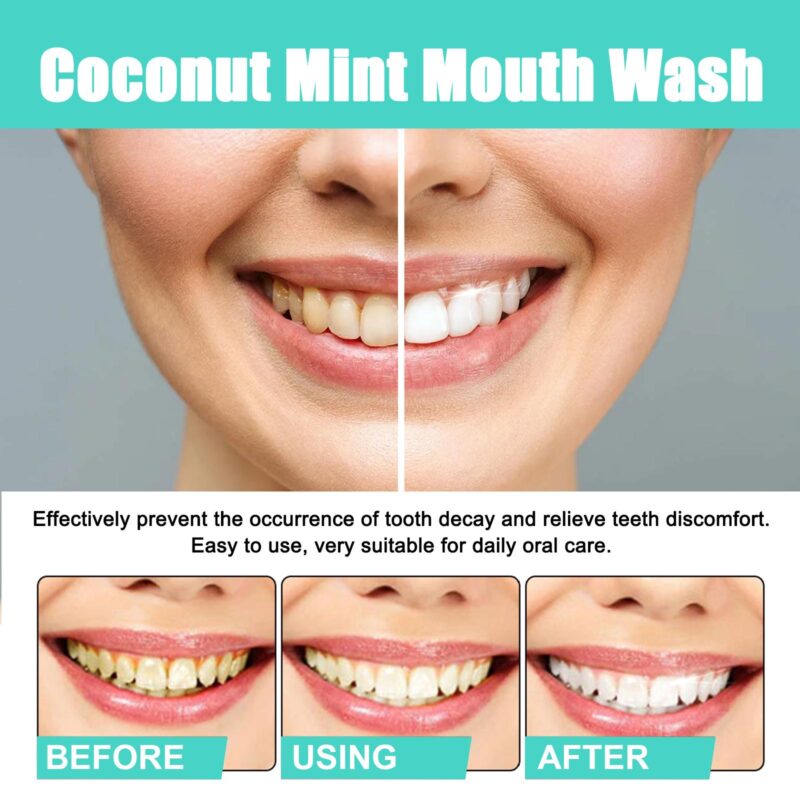 Coconut Mint Mouthwash - Yellow Stain/Tongue Clean, Teeth Whitening & Fresh Breath, Oral Care - Image 4