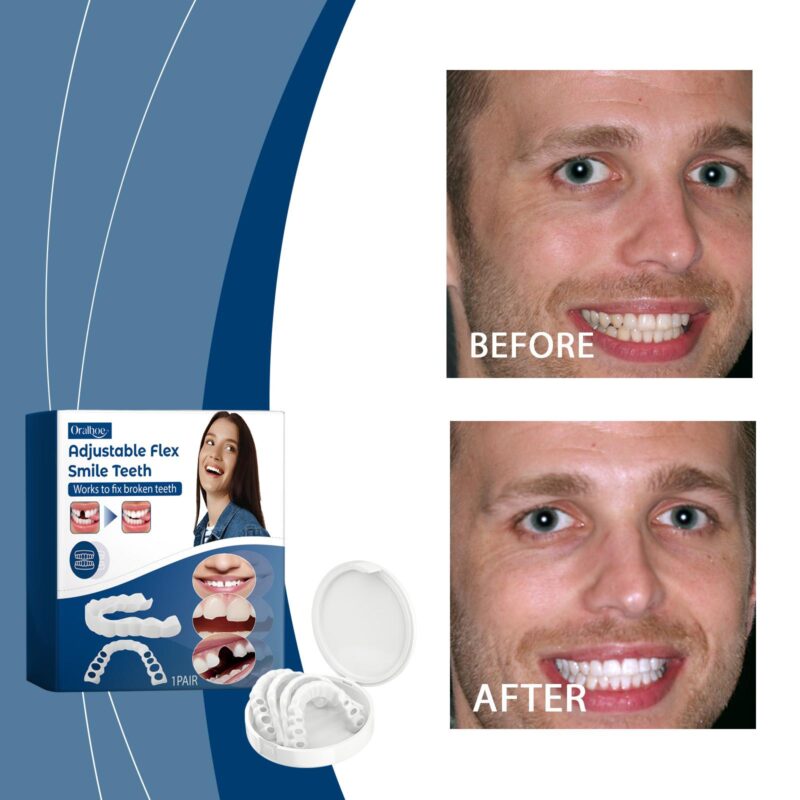Adjustable Buckle Dentures - Artificial Braces, Temporary Filling & Orthodontic Care, Denture Set - Image 2
