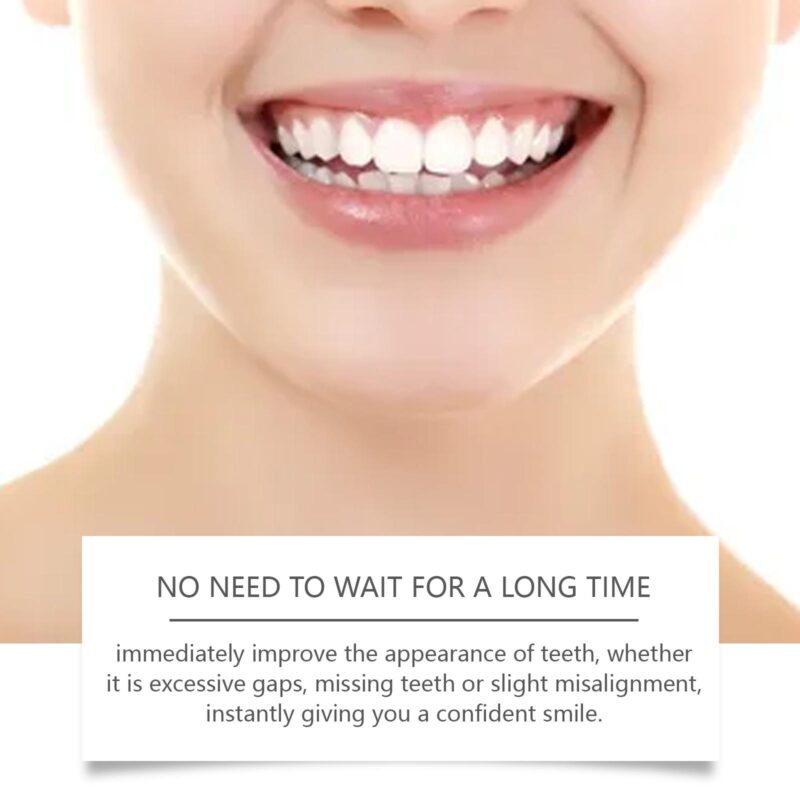 Adjustable Buckle Dentures - Artificial Braces, Temporary Filling & Orthodontic Care, Denture Set - Image 3
