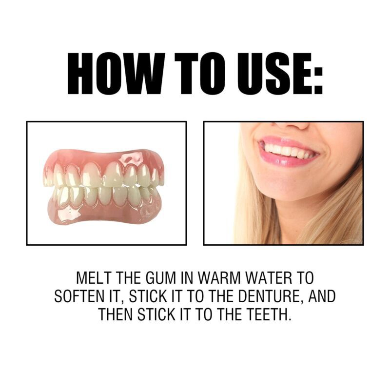 Soft Denture Reline Kit - Interdental Fillings/Braces Care, Denture Set & Comfort Fit, Oral Kit - Image 6