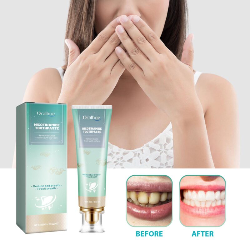 Nicotinamide Toothpaste - Whitening Teeth, Tartar/Yellow Stain Removal & Fresh Breath, Oral Care - Image 2