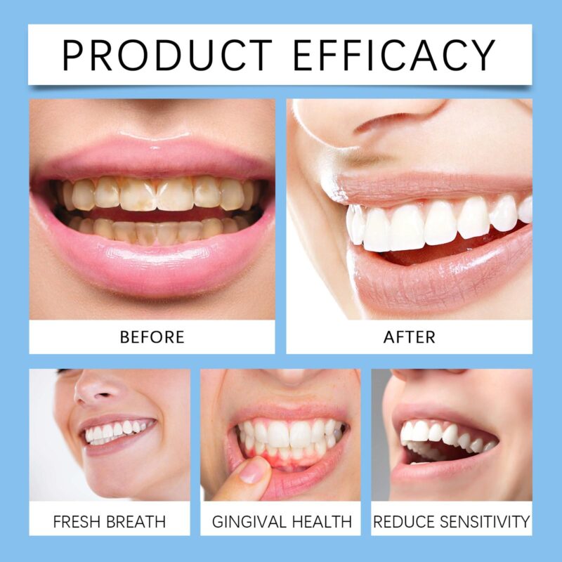 Coconut Mint Oil Mouthwash - Fresh Breath, Gum Care & Stain Removal, Coconut Mint Formula - Image 4