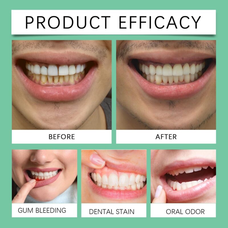 Oral Gums Mild Care Gel - Gentle Gum Care, Soothing Formula & Oral Health Improvement, Gel - Image 4