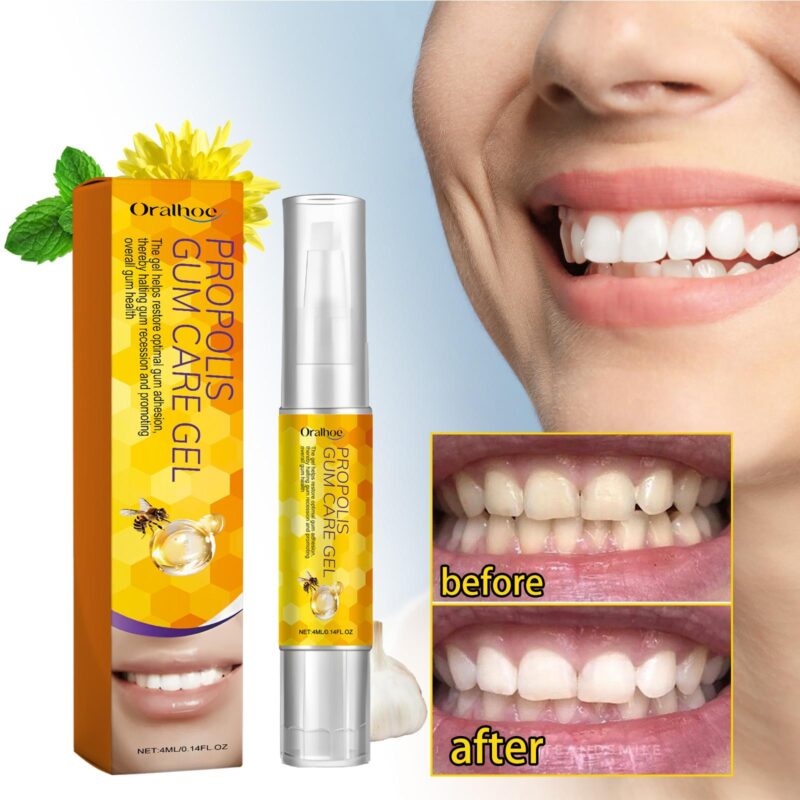 Propolis Gum Care Gel - Oral Care, Clean/Repair Teeth & Yellow Stain Whitening, Gum Gel - Image 2