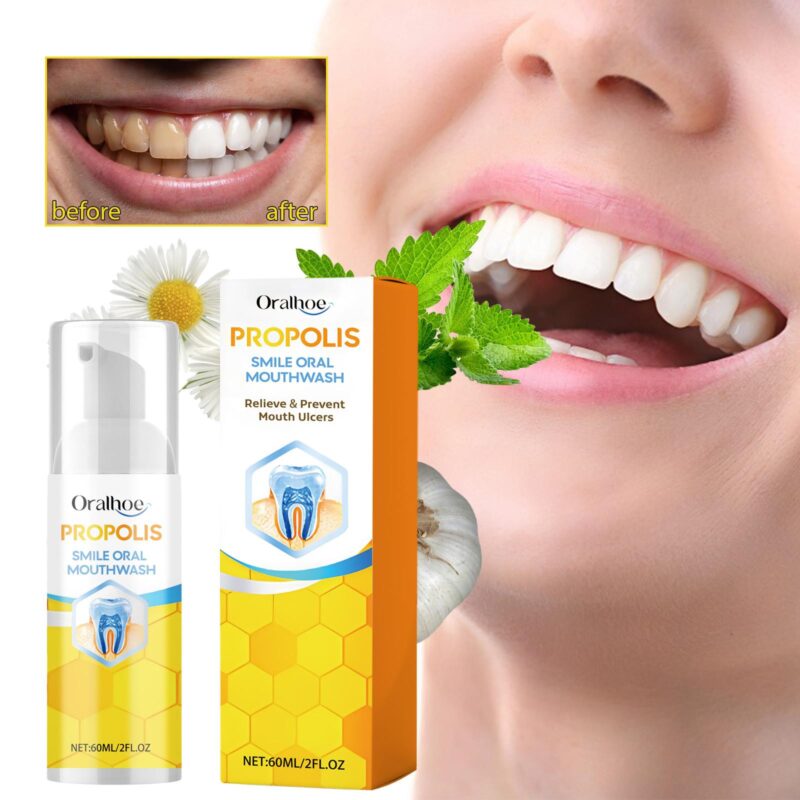Propolis Oral Cleaning Mousse - Tooth Stain Removal, Fresh Breath & Oral Care, Foaming Mousse - Image 2