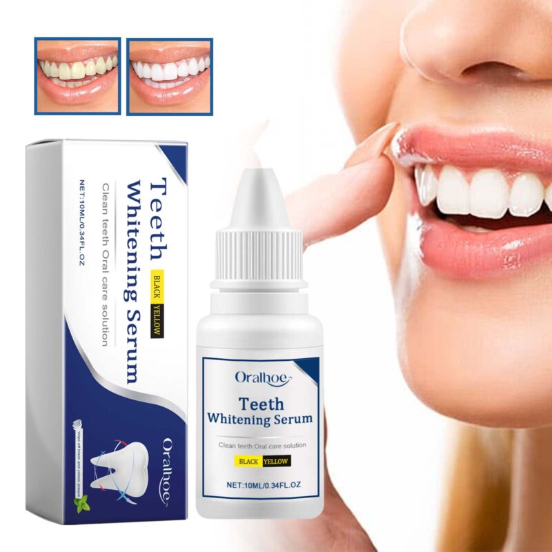 Teeth Whitening Serum - Deep Stain Removal, Yellowing Control & Whitening Essence, Oral Care - Image 2