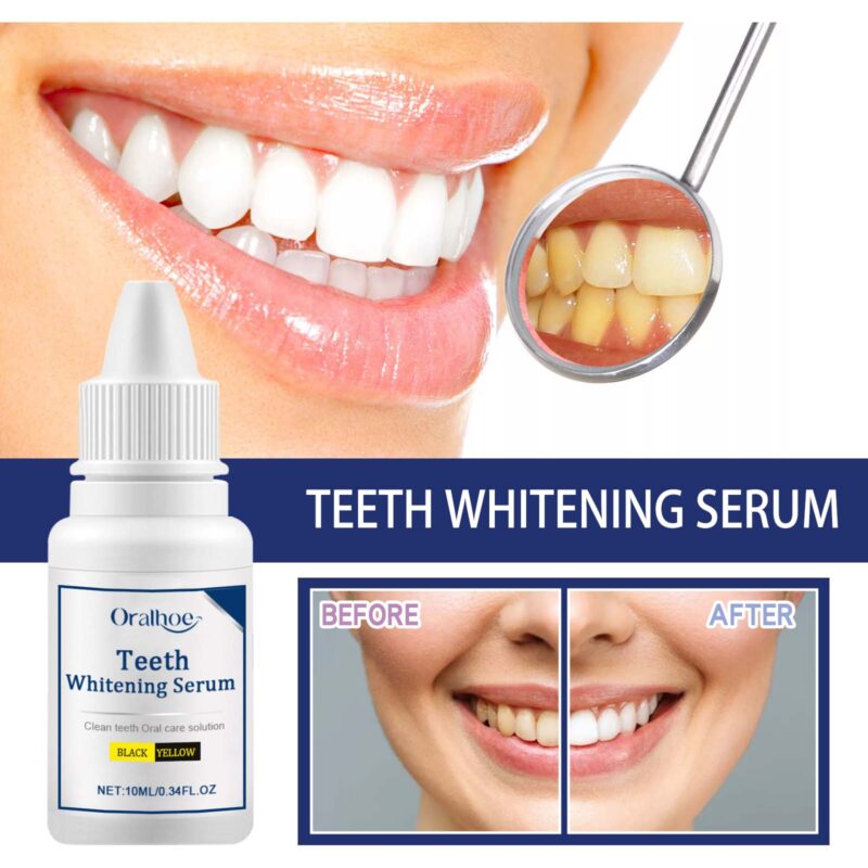 Teeth Whitening Serum - Deep Stain Removal, Yellowing Control & Whitening Essence, Oral Care - Image 3
