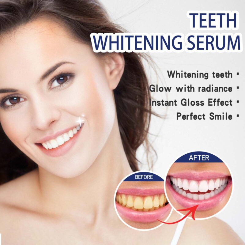 Teeth Whitening Serum - Deep Stain Removal, Yellowing Control & Whitening Essence, Oral Care - Image 4