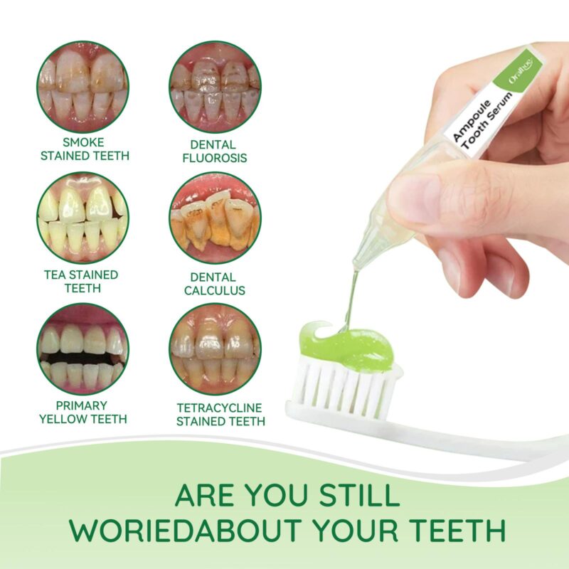 Teeth Whitening Serum - Deep Stain/Yellow Care, Teeth Whitening & Oral Cleaning, Serum - Image 3