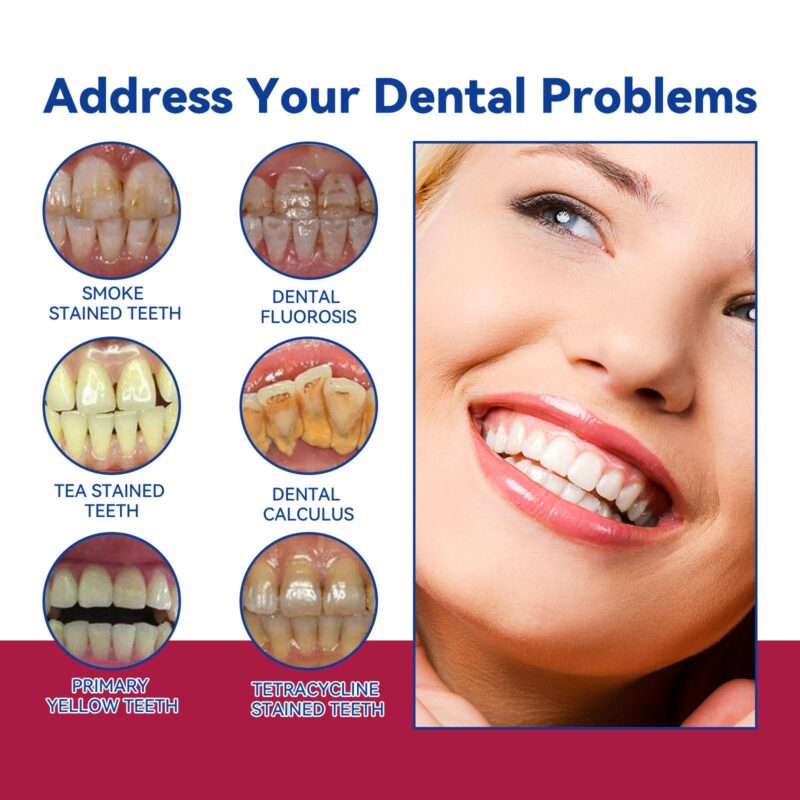 Anti-Cavity Gum Health Toothpaste - Yellow Stain/Tartar Removal, Fresh Breath & Gum Care, Toothpaste - Image 3
