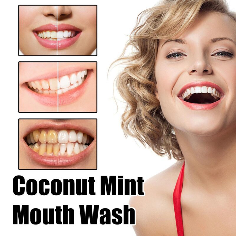 Coconut Mint Mouthwash - Tongue Coating Clean, Teeth Whitening & Fresh Breath, Oral Care - Image 3