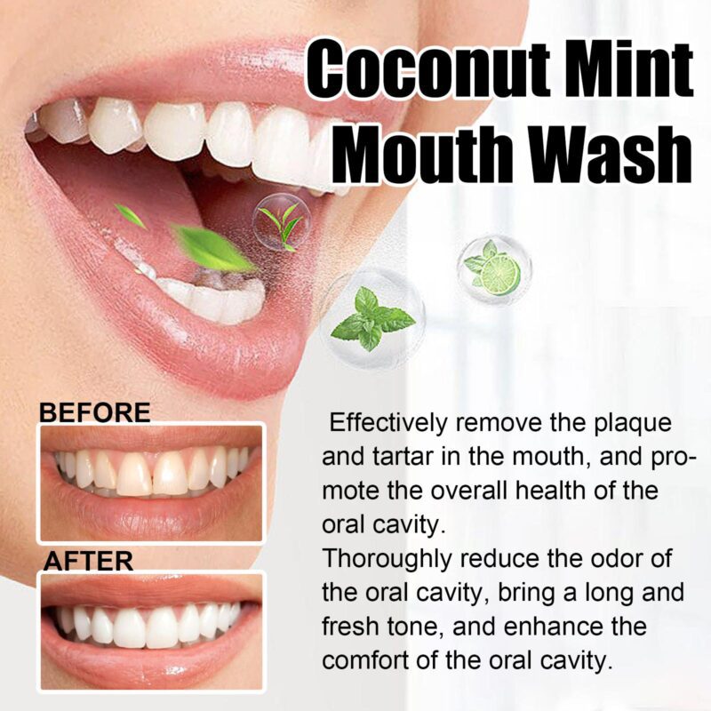 Coconut Mint Mouthwash - Tongue Coating Clean, Teeth Whitening & Fresh Breath, Oral Care - Image 4
