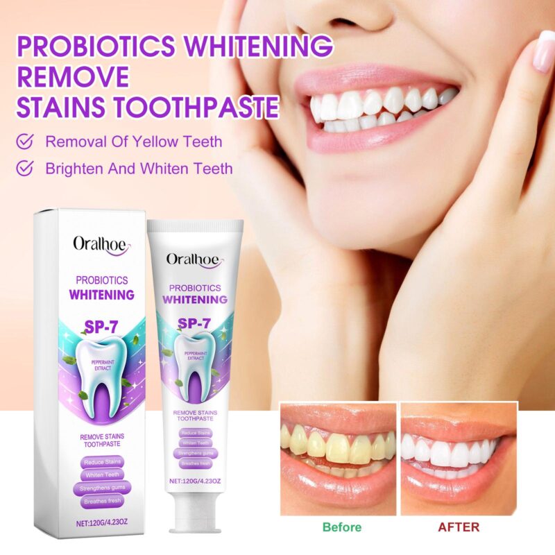 Probiotics Whitening Toothpaste - Dental Care, Oral Odor/Stain/Tartar Removal, Teeth Beautifying - Image 2