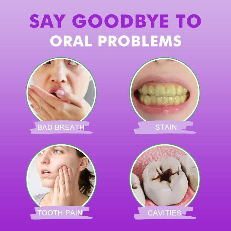 Probiotics Whitening Toothpaste - Dental Care, Oral Odor/Stain/Tartar Removal, Teeth Beautifying - Image 3