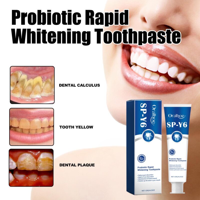 Probiotic Rapid Whitening Toothpaste - Fresh Breath, Stain/Tartar Removal & White Teeth, Odor Elimination - Image 3