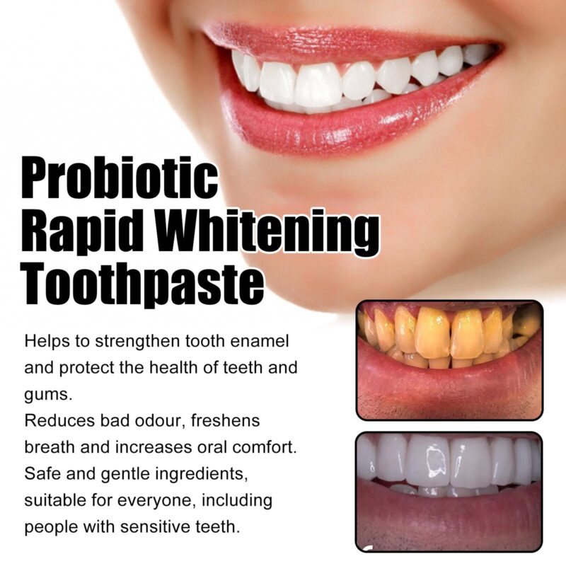 Probiotic Rapid Whitening Toothpaste - Fresh Breath, Stain/Tartar Removal & White Teeth, Odor Elimination - Image 4