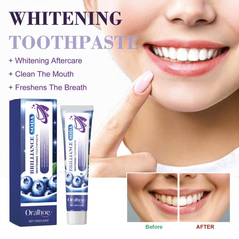 Whitening Toothpaste - Gum Care, Yellow Stain/Tartar Removal & Fresh Breath, Daily Use - Image 2