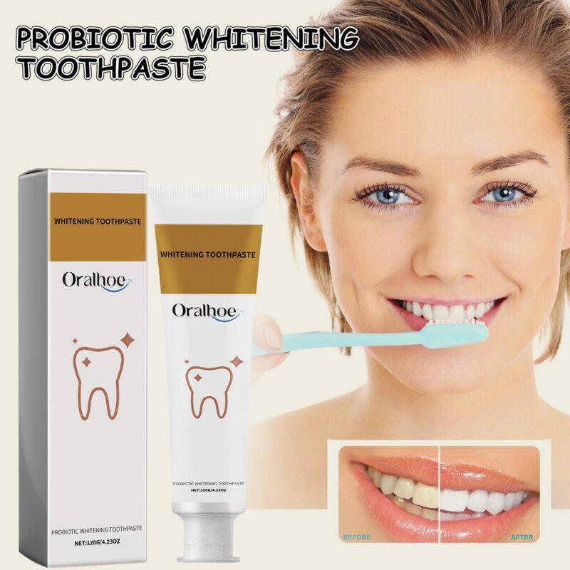 Probiotic Whitening Toothpaste - Stain Removal, Gum Care & Oral Hygiene, Teeth Whitening - Image 2