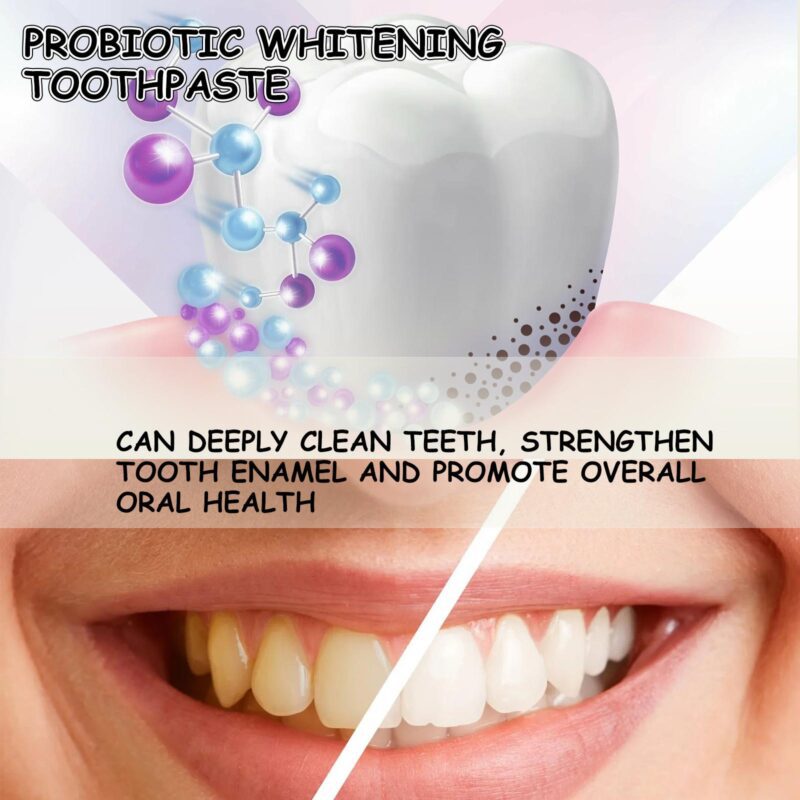 Probiotic Whitening Toothpaste - Stain Removal, Gum Care & Oral Hygiene, Teeth Whitening - Image 3