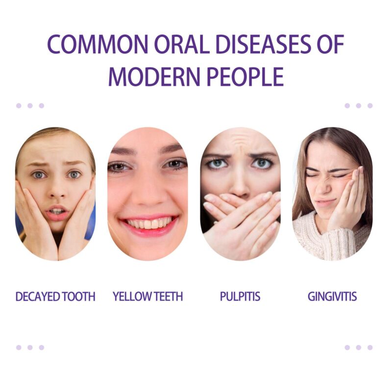 Purple Whitening Toothpaste - Fresh Mouth, Yellow Tartar Removal & Teeth Whitening, Dental Care - Image 3