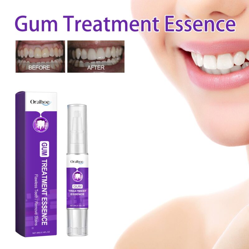 Gum Treatment Essence - Oral Cleaning, Teeth Whitening & Gum Beautification, Dental Pen - Image 2