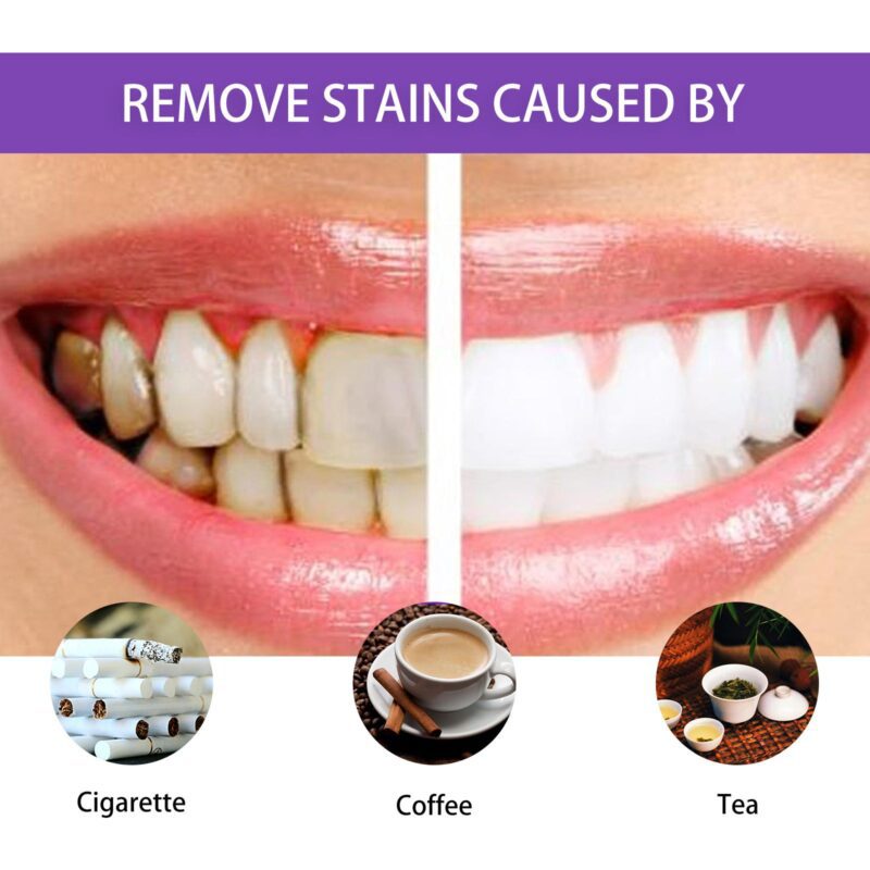 Gum Treatment Essence - Oral Cleaning, Teeth Whitening & Gum Beautification, Dental Pen - Image 3