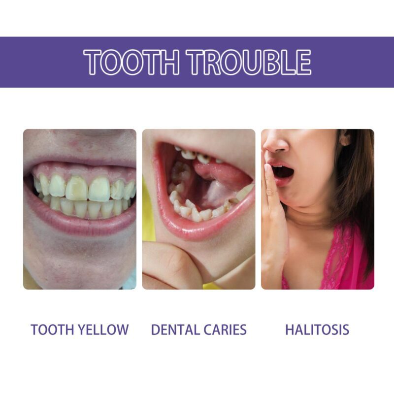 Oralhoe Purple Teeth Whitening Serum - Stain Removal & Fresh Breath - Image 3