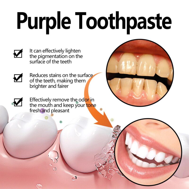 Purple Toothpaste - Deep Tartar/Stain Removal, Fresh Breath & Gentle Formula, Toothpaste - Image 3