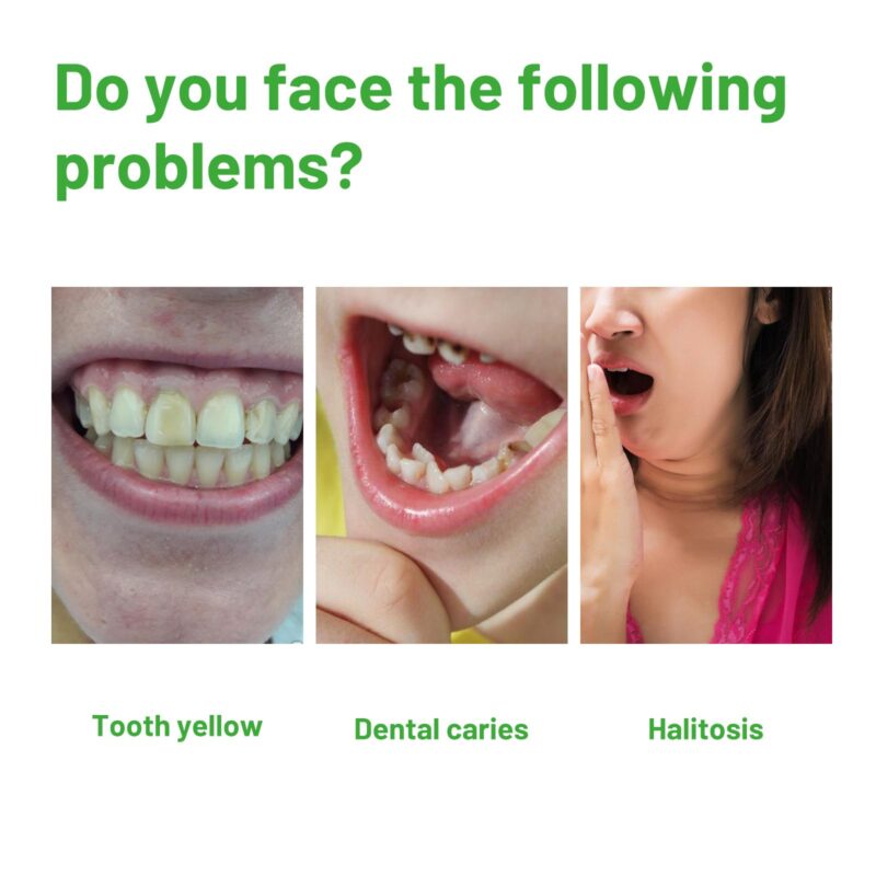 Herbal Oral Foam - Tartar Deep Cleaning, Fresh Breath & Teeth Whitening, Oral Mousse - Image 3