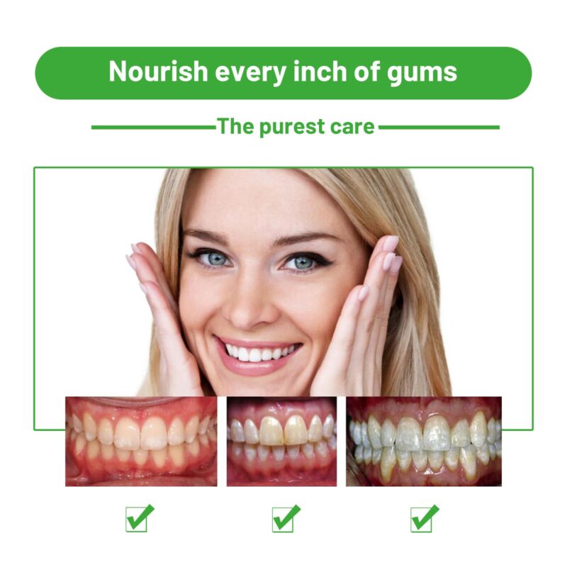 Herbal Oral Foam - Tartar Deep Cleaning, Fresh Breath & Teeth Whitening, Oral Mousse - Image 4
