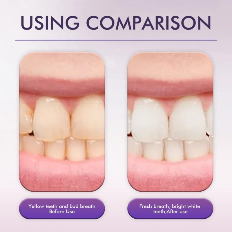 Oralhoe Clean Toothpaste - Whitening, Yellow Stain Removal & Fresh Breath - Image 3