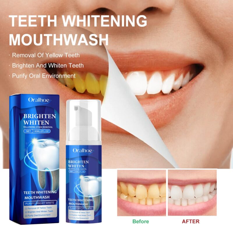 Teeth Whitening Mouthwash - Yellow Stain/Tartar Removal, Fresh Breath & Beauty Care, Oral Rinse - Image 2