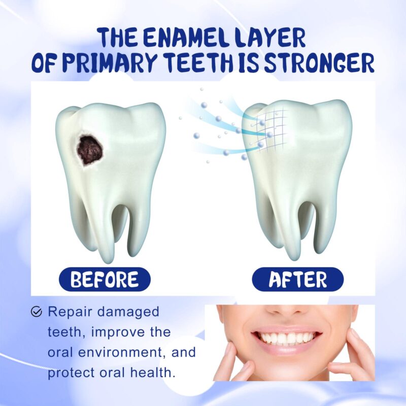 Anti-Cavity Toothpaste - Gingival Reinforcement, Caries Prevention & Fresh Breath, Dental Care - Image 3