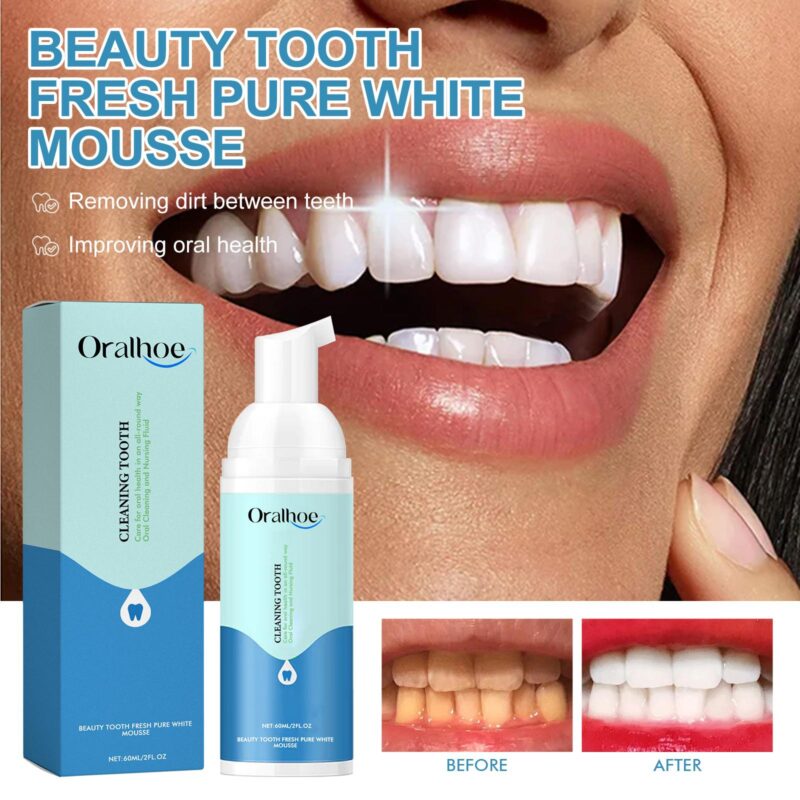 Beauty Tooth Mousse - Bad Breath/Stain Removal, Gum Care & White Teeth, Foaming Toothpaste - Image 2