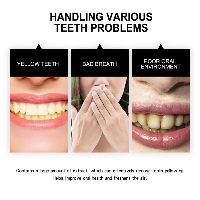 Teeth Whitening Powder - Tartar/Yellow/Smoke Stain Care, Oral Cleaning Powder - Image 3