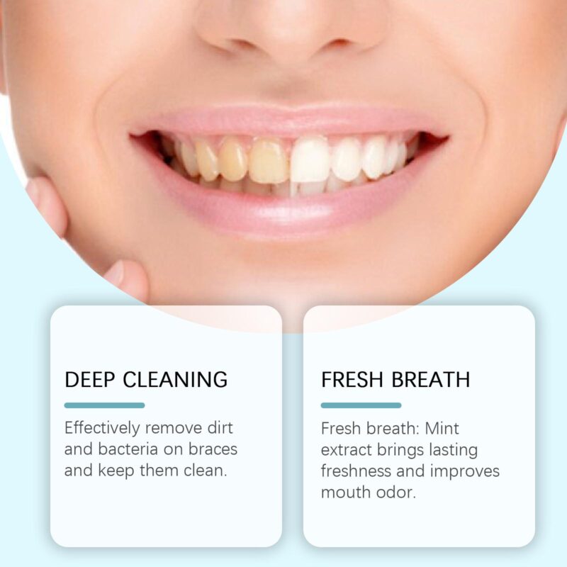 Braces Cleansing Mousse - Gentle Foam Cleaning, Fresher Mouth & Orthodontic Care, Oral Mousse - Image 2