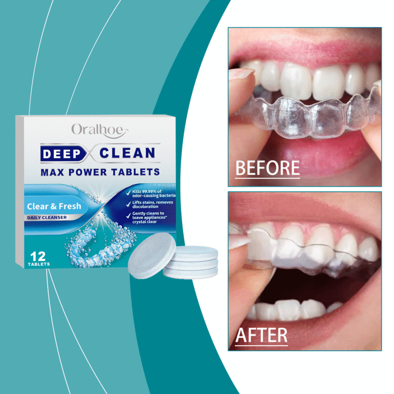 Orthodontic Cleaning Tablets - Gentle Odor/Stain Removal, Braces Care & Oral Hygiene, Effervescent - Image 2