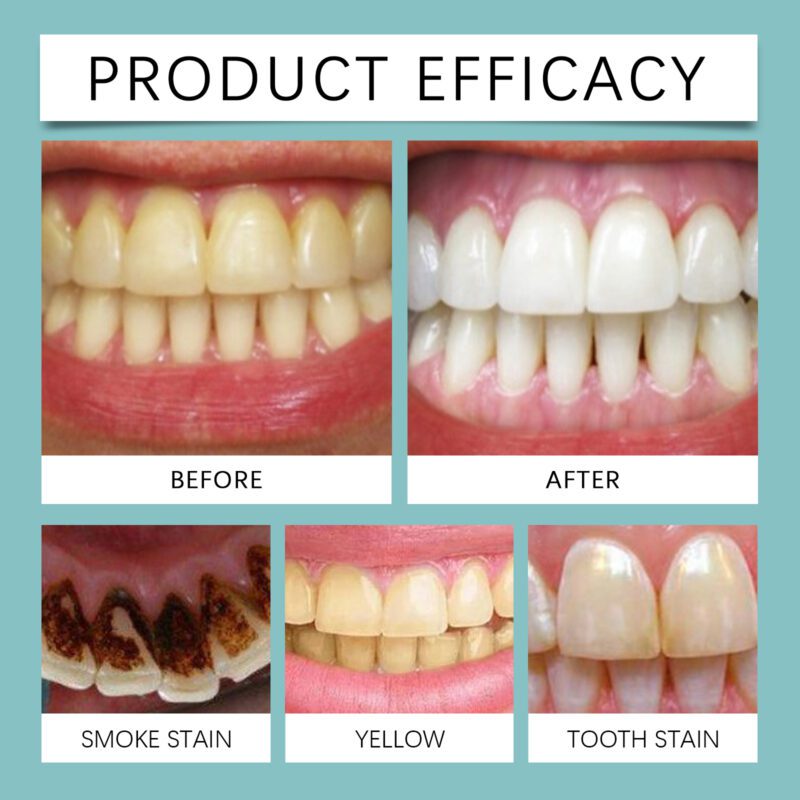 Instant Whitening Paint - Tartar Removal, Teeth Brightening & Long-Lasting Freshness, Dental Care - Image 4