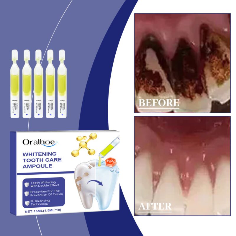 Whitening Serum - Deep Stain Removal, Yellowing Control & Oral Care, Teeth Brightening - Image 2