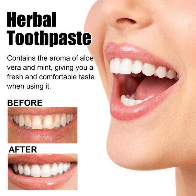 Aloe Whitening Toothpaste - Odor/Stain Removal, Fresh Breath & Teeth Brightening, Toothpaste - Image 4
