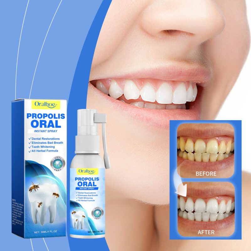 Oralhoe Propolis Oral Spray for Gum Protection, Stain Removal & Fresh Breath - Image 2