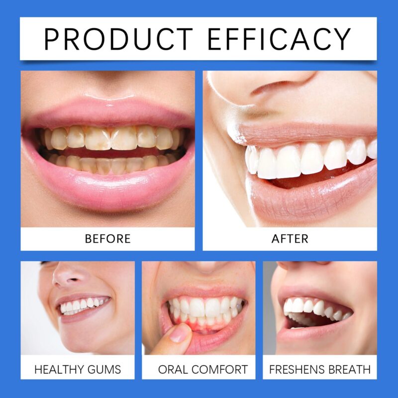 Oralhoe Propolis Oral Spray for Gum Protection, Stain Removal & Fresh Breath - Image 3